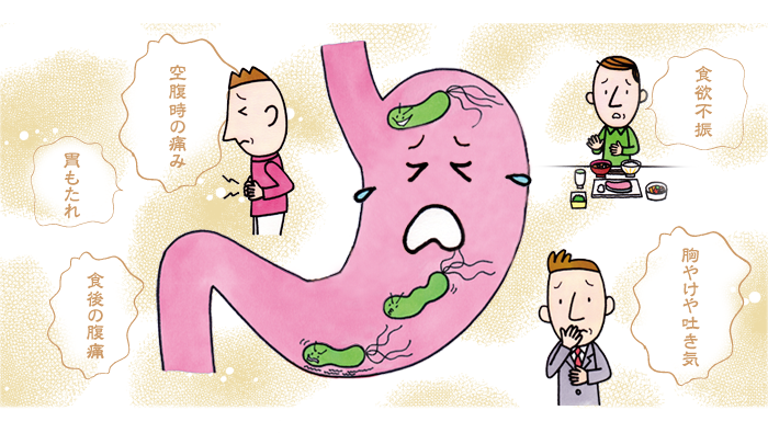 ピロリ菌,検査,商品,キット,治療