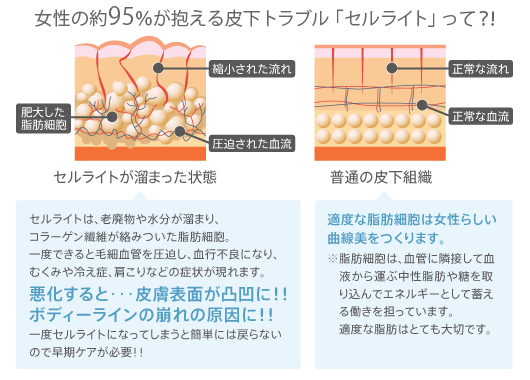 セルライト,サプリ,サプリメント,飲み方,効果
