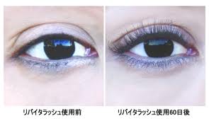 リバイタラッシュ,失明