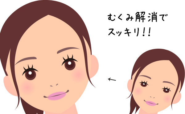 ラシックス,ジェネリック